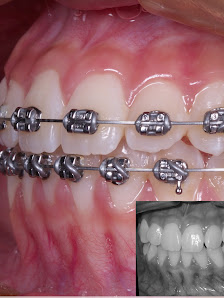 GiO Dental Care & Clinic AMBARUKMO