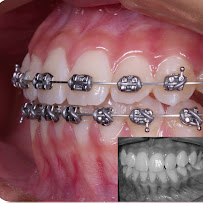 GiO Dental Care & Clinic AMBARUKMO