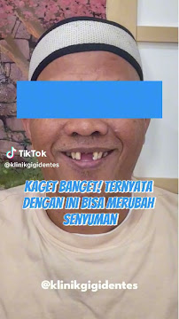 Klinik Gigi Dentes Jl. Solo | Dentes Dental Clinic | Pasang Behel Jogja | Dokter Gigi Terdekat