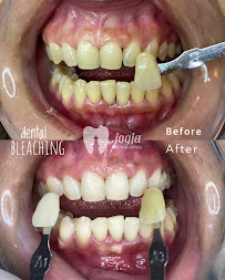Jogja Dental Clinic