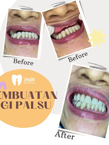 Jogja Dental Clinic