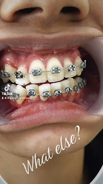 Dokter gigi SAY dental care pandeyan jogja