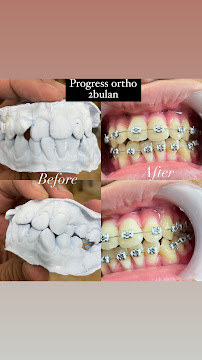 Dokter gigi SAY dental care pandeyan jogja