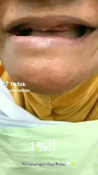 Dokter gigi SAY dental care pandeyan jogja