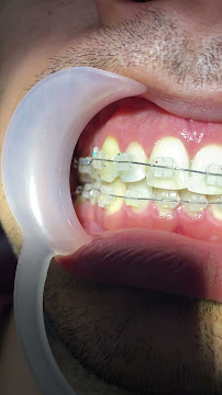 Dokter gigi SAY dental care pandeyan jogja