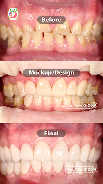 GiO Dental Care & Clinic MONJALI