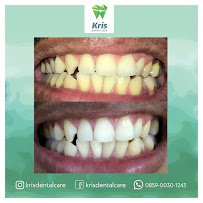 KRIS DENTAL CARE
