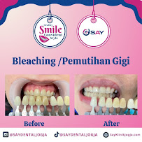 Dokter gigi SAY dental care maguwoharjo Jogja
