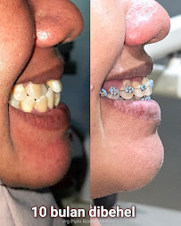 Dentist Practice Pipin Ikawati