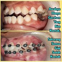 Dentist Practice Pipin Ikawati