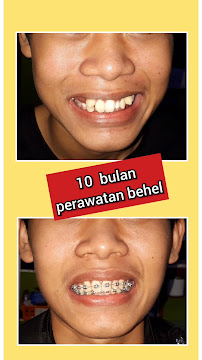Dentist Practice Pipin Ikawati