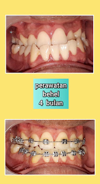 Dentist Practice Pipin Ikawati