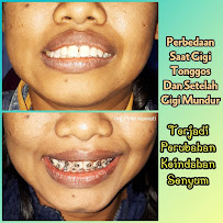 Dentist Practice Pipin Ikawati