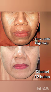 Dentist Practice Pipin Ikawati