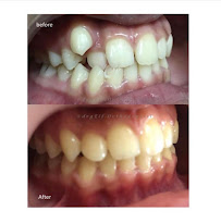 Praktek Dokter Gigi Spesialis Orthodonti - Spesialis Kawat Gigi (drg. Elfira Maharani, M.P.H., Sp.Ort.)