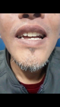 AHLI GIGI DAYAT DENTAL