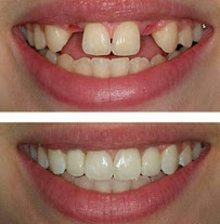 AHLI GIGI DAYAT DENTAL