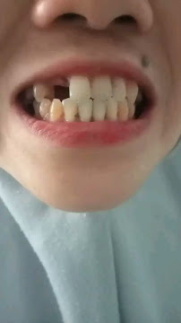AHLI GIGI DAYAT DENTAL