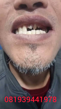 AHLI GIGI DAYAT DENTAL