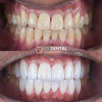 Klinik Gigi Surabaya - CS Dental Aesthetic Clinic & Dental Lab