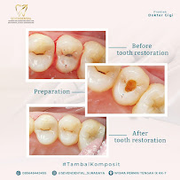 Seven Dental Clinic Surabaya (Klinik Akar Gigi Sby)