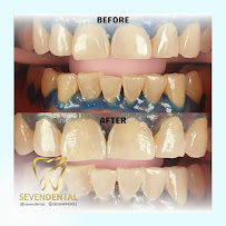 Seven Dental Clinic Surabaya (Klinik Akar Gigi Sby)