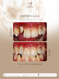 Seven Dental Clinic Surabaya (Klinik Akar Gigi Sby)