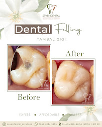 Klinik Gigi Sevendental Surabaya (PT. Seven Society Indonesia)