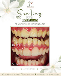 Klinik Gigi Sevendental Surabaya (PT. Seven Society Indonesia)