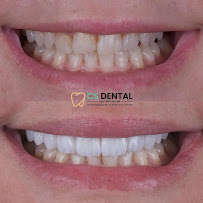 Klinik Gigi Surabaya Barat - CS Dental Citraland