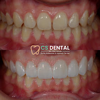 Klinik Gigi Surabaya - CS Dental Pantai Mentari Kenjeran