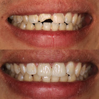 KLINIK GIGI UTAMA DENTHAUS AESTHETIC DENTAL CLINIC