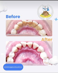 Dokter Gigi Surabaya Vitalis dental solutions d/h integra dental