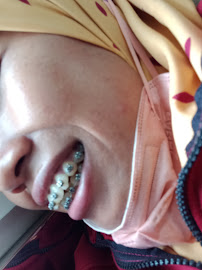 BEAUDENT Merr