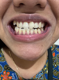 Azzahra Dental Care - Surabaya (Dokter Gigi Surabaya)