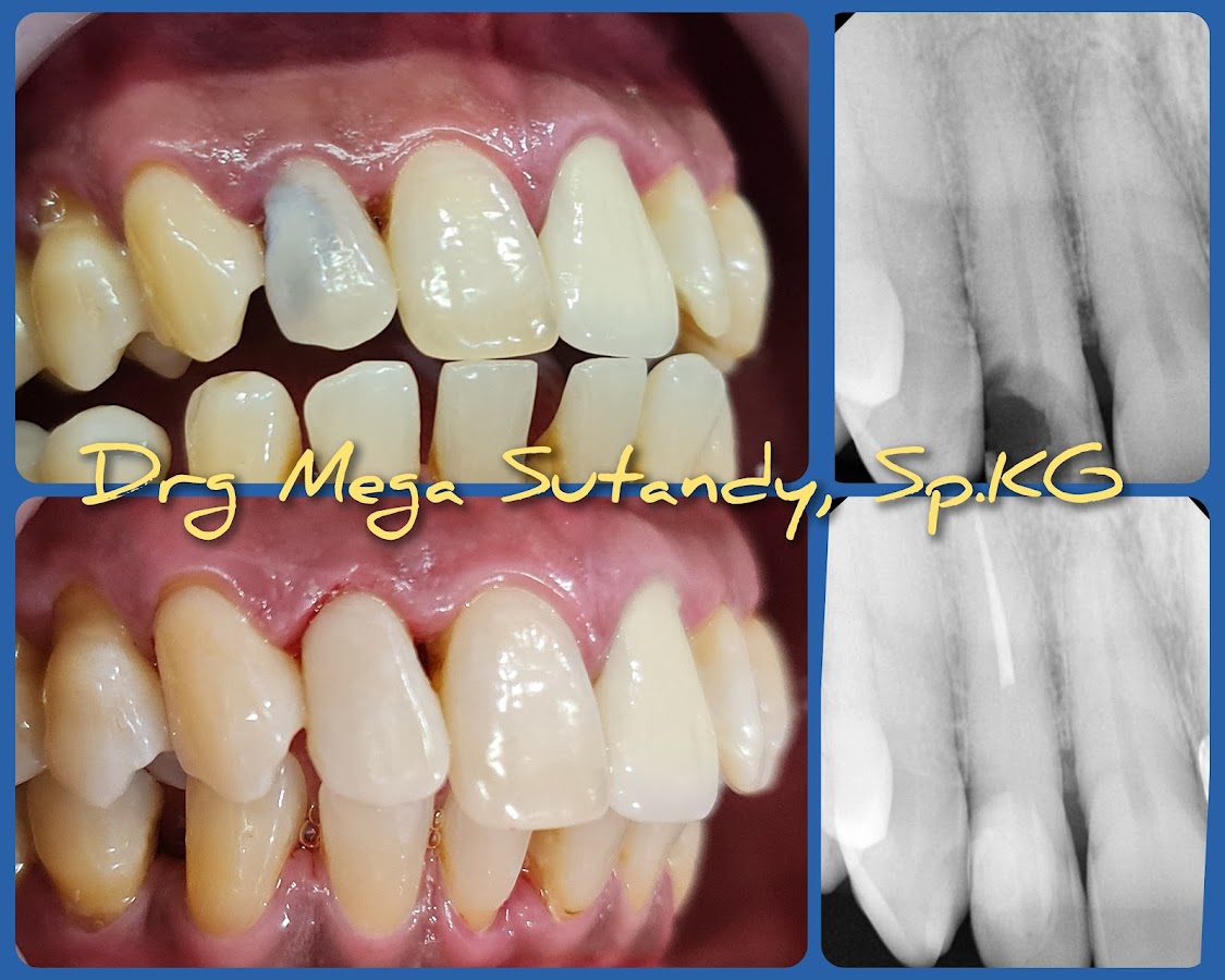 Mega Dental - dental clinic in Surabaya, Indonesia