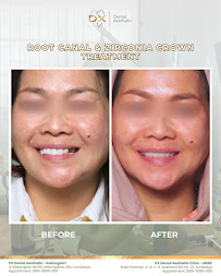 DX Dental Aesthetic Clinic (Dokter Gigi Spesialis Surabaya) - MERR