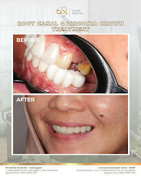 DX Dental Aesthetic Clinic (Dokter Gigi Spesialis Surabaya) - MERR