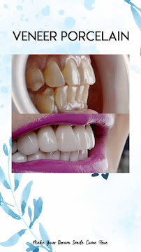 Dental Room PTC Implant and Esthetics