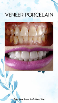 Dental Room PTC Implant and Esthetics