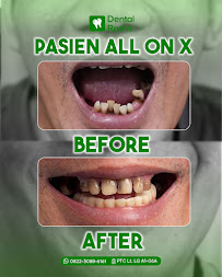 Dental Room PTC Implant and Esthetics