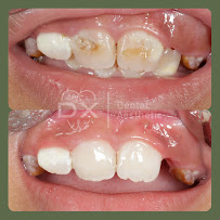 DX Dental Aesthetic (Dokter Gigi Spesialis Surabaya)
