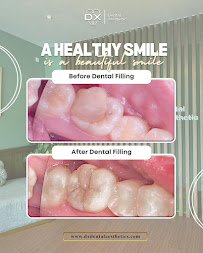 DX Dental Aesthetic (Dokter Gigi Spesialis Surabaya)