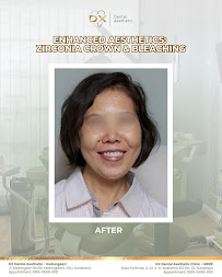 DX Dental Aesthetic (Dokter Gigi Spesialis Surabaya)