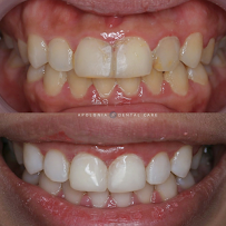 Apolonia Dental Care Surabaya - Klinik Dokter Gigi Surabaya Barat