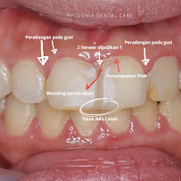 Apolonia Dental Care Surabaya - Klinik Dokter Gigi Surabaya Barat