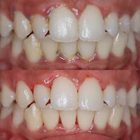 Apolonia Dental Care Surabaya - Klinik Dokter Gigi Surabaya Barat