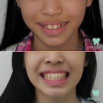 Dokter Gigi Spesialis Ortodonti - Orthodontist Surabaya Kerry Anogia