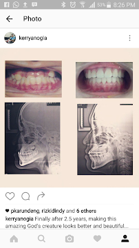 Dokter Gigi Spesialis Ortodonti - Orthodontist Surabaya Kerry Anogia