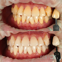 Dentme Aesthetic Dental Clinic